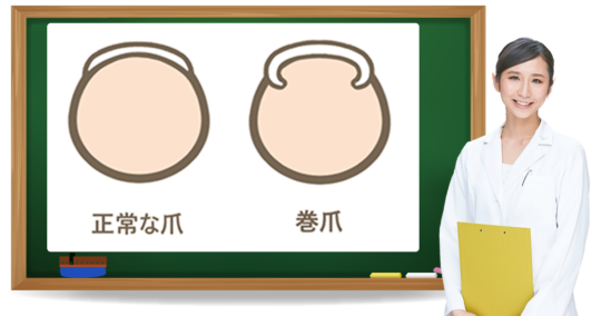 巻き爪とは?症状・原因・予防方法|フットケア推進室 巻き爪とは?症状・原因・予防方法|フットケア推進室