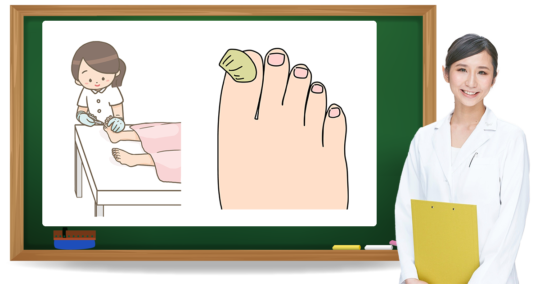 肥厚爪とは?症状・原因・予防方法|フットケア推進室 肥厚爪とは?症状・原因・予防方法|フットケア推進室