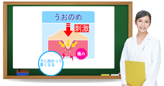 魚の目とは?症状・原因・予防方法|フットケア推進室 魚の目とは?症状・原因・予防方法|フットケア推進室
