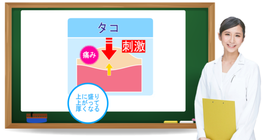 タコとは?症状・原因・予防方法|フットケア推進室 タコとは?症状・原因・予防方法|フットケア推進室