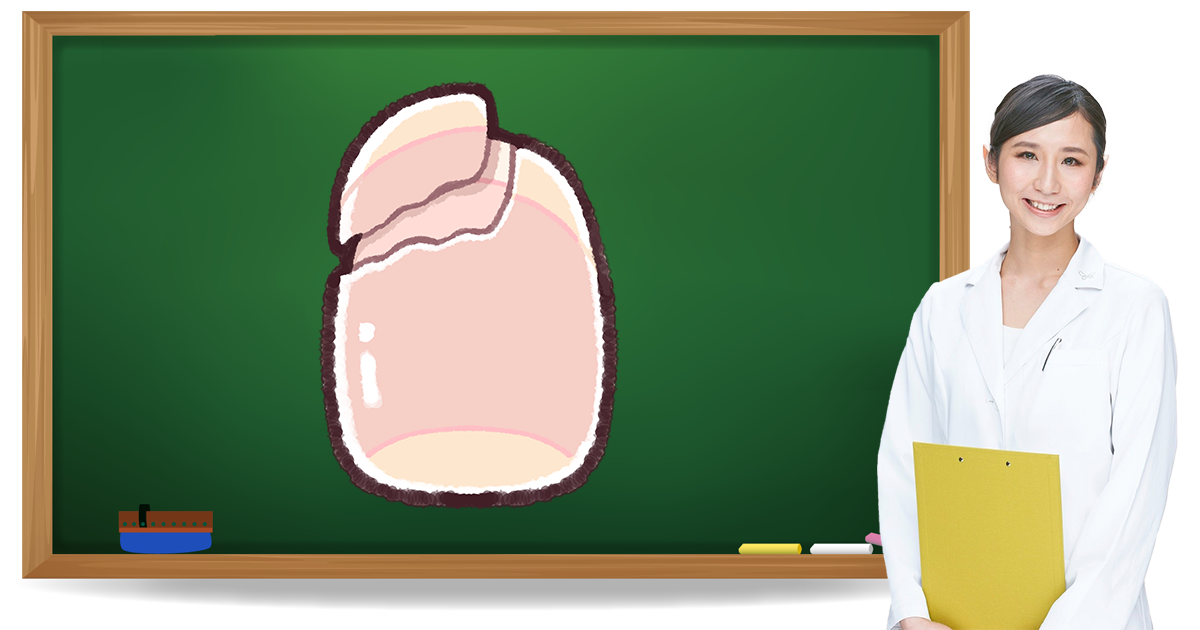 二枚爪とは？症状・原因・予防方法